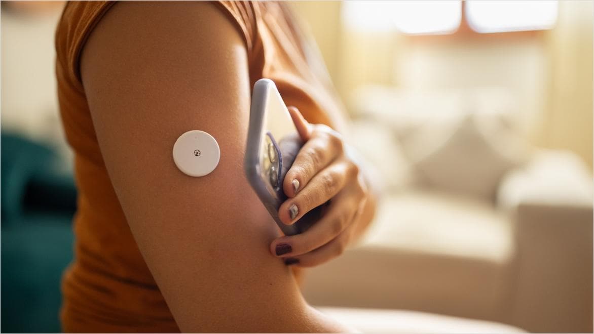 Close-up of CGM sensor on a woman’s arm, her other hand holding a cellphone close to the sensor to get a reading.