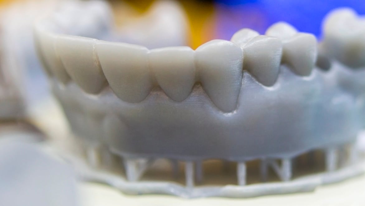 A model of teeth in a jaw created using stereolithography.