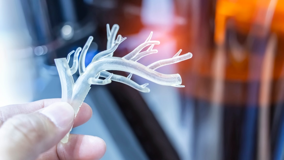 Close up of a hand holding a 3D printed object shaped like human blood vessels.