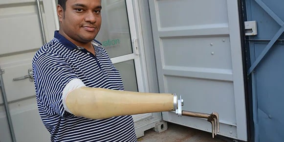 Ein Mann zeigt stolz seine Armprothese 